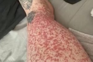 Never Knew these are the consequences of sleeping with?!