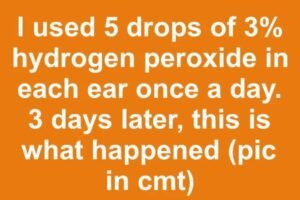 I Tried Five Drops Of Hydrogen Peroxide In Each Ear For Three Days And What Happened Surprised Me
