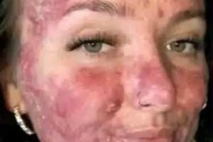 Her body was itchy, he thought it was an allergy