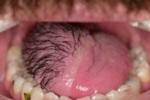 These are the consequences of sleeping with…See more