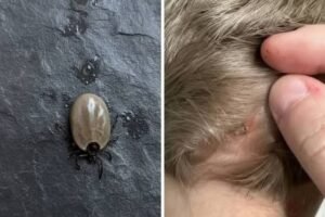 The Little Scalp Intruder: How Parents Can Handle Unwanted Bugs in Their Child’s Hair