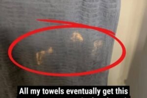 Why Mysterious Orange or Bleached-Looking Stains Keep Appearing on Your Towels, What Everyday Skincare Ingredients Like Benzoyl Peroxide Are Really Doing to Your Fabrics, and the Simple, Practical Ways You Can Prevent, Fix, and Stop Ruining Your Towels Without Giving Up Your Acne Routine