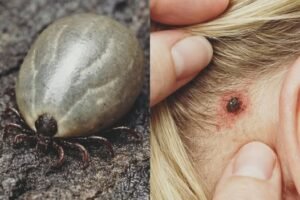 Found a Weird Bug in Your Child’s Hair? Important Info for Parents