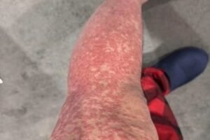 These are the consequences