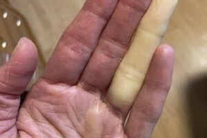 These are the consequences of sleeping with the… See more