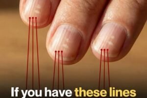 Why Vertical Nail Ridges Become More Noticeable as You Get Older