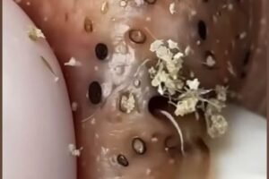 Body Alerts For Possible Health Issues