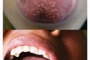 8 Things That Your Tongue Tell You About Your Health…