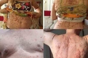 How Your Sleeping Environment Can Quietly Affect Your Skin Health Over Time