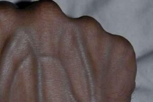 If you have visible veins, it means you are…