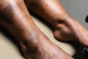 These are the consequences of sleeping with a…