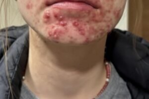 These are the first symptoms of sleeping with…