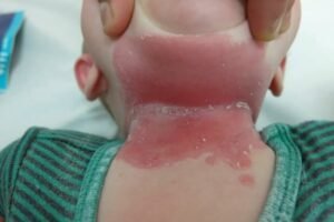 These are the consequences of sleeping with!…See more