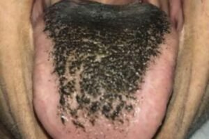 These are the consequences of sleeping with the…