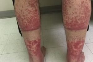 These are the consequences of sleeping with, See it!