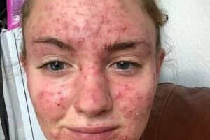 Her body was itching, I thought it was an allergy