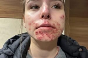 These are the consequences of sleeping with a. See more!