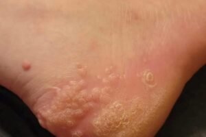 These are the consequences of wearing used…