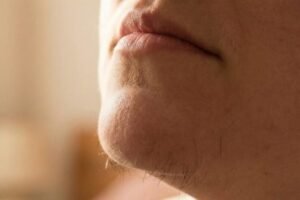 Chin Hair in Women: Why It Happens and How to Manage It Confidently