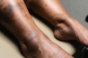 What That Sudden Red Patch on Your Skin Could Be Telling You About Your Health