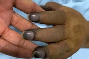 These are the consequences of painting your nails