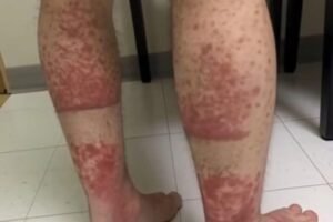 These are the consequences of sleeping with…See more