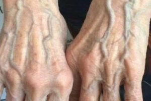 If you have visible veins, it means you are…