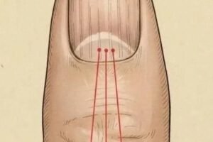 If you have these lines on your nails after 40, it is a clear sign that..
