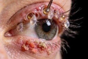 These are the consequences of sleeping with a… See more