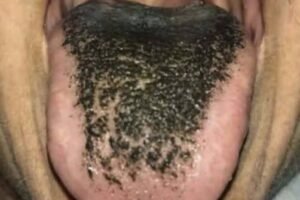 These are the consequences of sleeping with the… See more