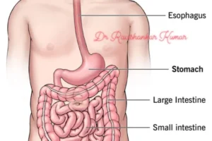 Cᴀɴᴄᴇʀ in the stomach develops silently