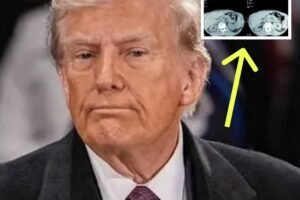 Internet On Edge After Trump Reveals The Results Of His MRI Scan