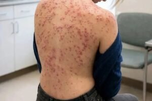 These are the consequences of sl2