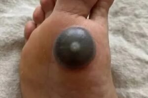 My daughter woke up with this huge