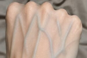 Visible Veins Explained: Normal Causes, Health Risks, and When to Worry!!