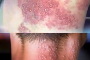 Genital Skin Changes: When to Worry and When to Relax