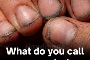What Dirty Fingernails Really Reveal