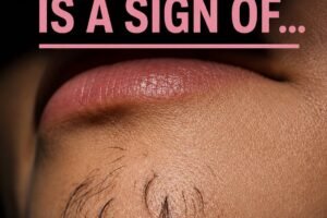 Why Chin Hair Grows in Women and What It May Indicate