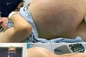 She went into labor, and you won’t believe what they took out of her wo…See More