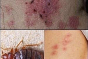 ⚠️ BE CAREFUL, If you spot these dots on your skin, it means you have Ca…see more