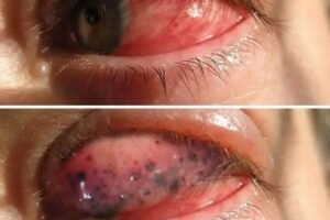 Could Your Mouth Be Sending a Warning? Early Signs of Oral Cancer to Watch For