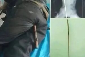 Young man hospitalized after be