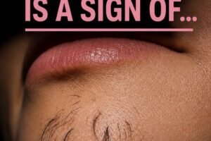 Why Chin Hair Grows in Women and What It M