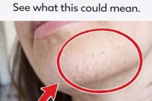 Common Reasons for Unwanted Facial Hair Growth in Women