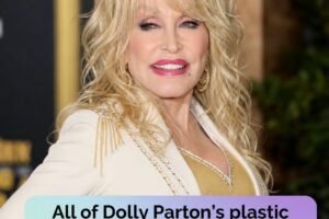 Dolly Parton’s unapologetic approach to beauty – years of procedures revealed